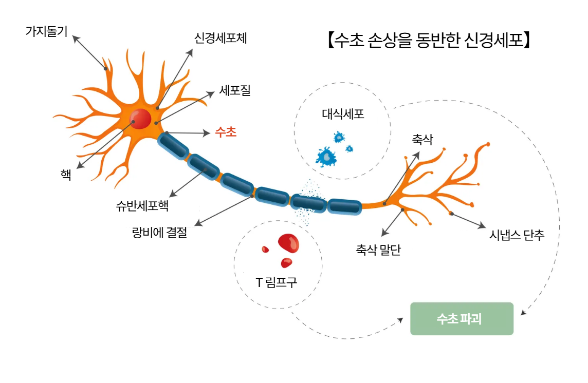 손상된 수초